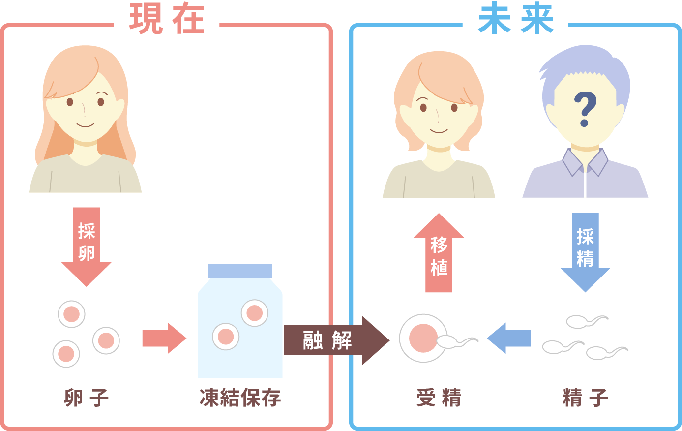 卵子凍結とは